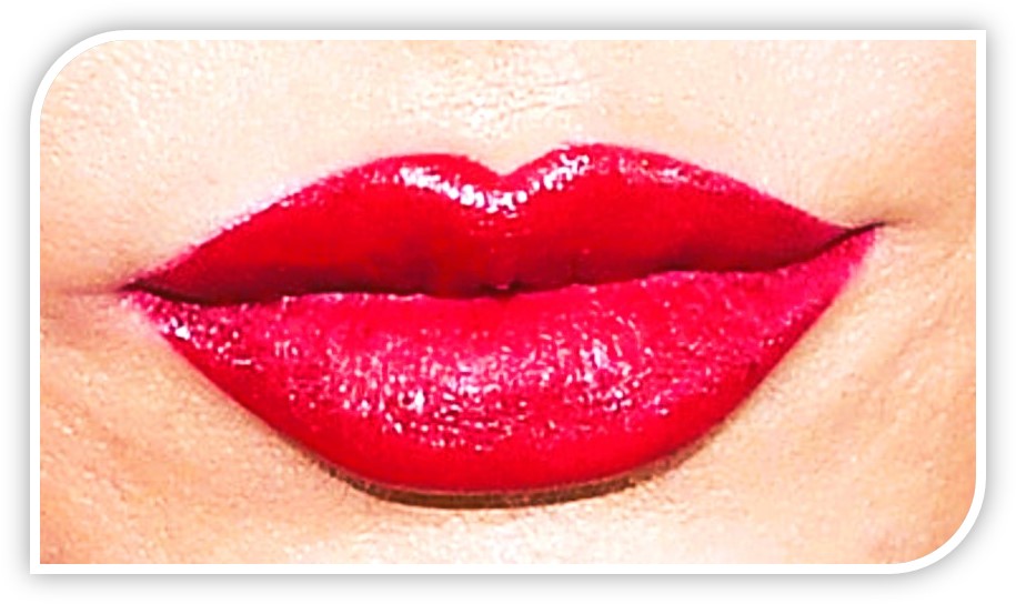 Russian Lips, Clinica Del Viso, Chirurgia Labbra Milano