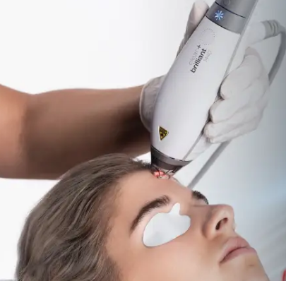 laser clear brilliant