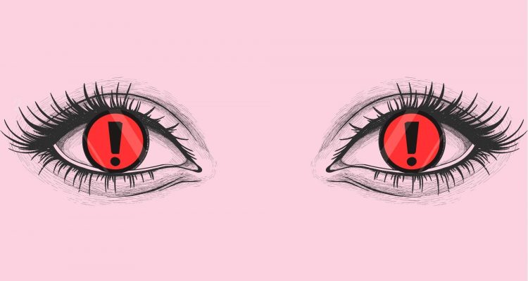 blefaroplastica di revisione