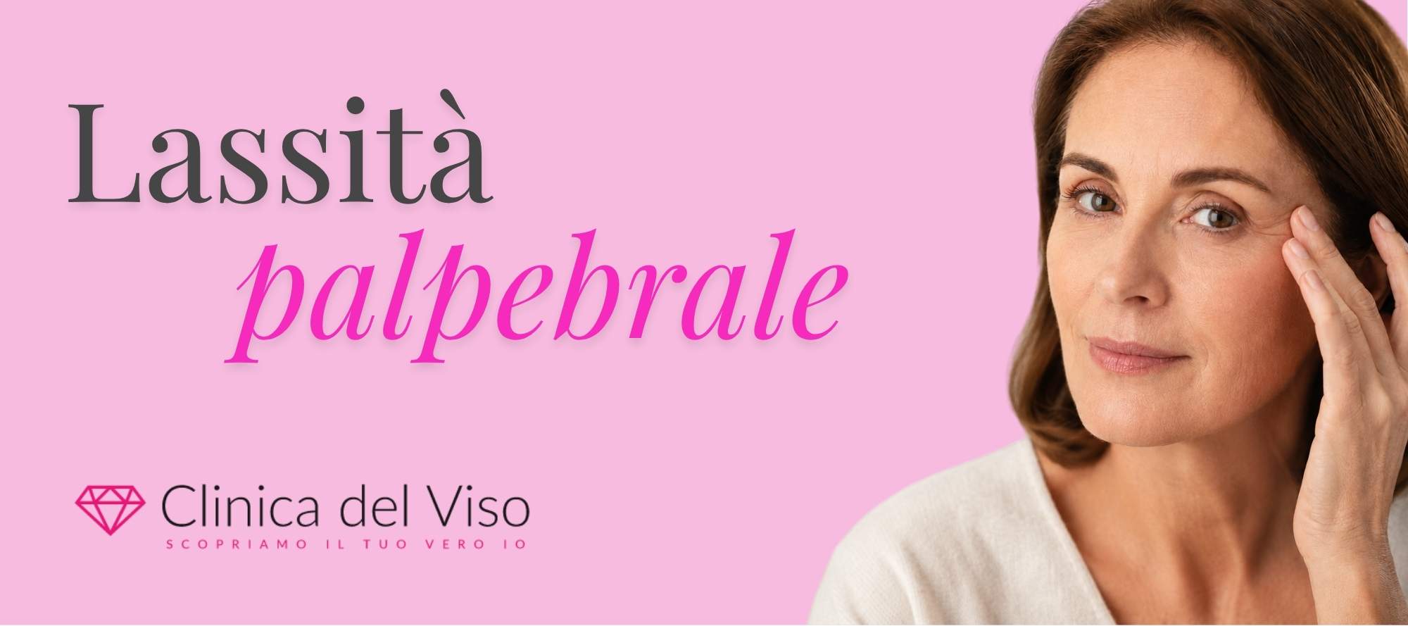 lassità palpebrale
