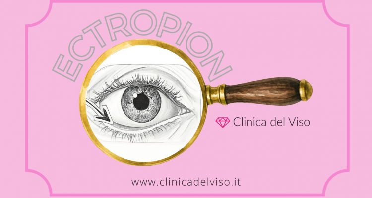 ectropion