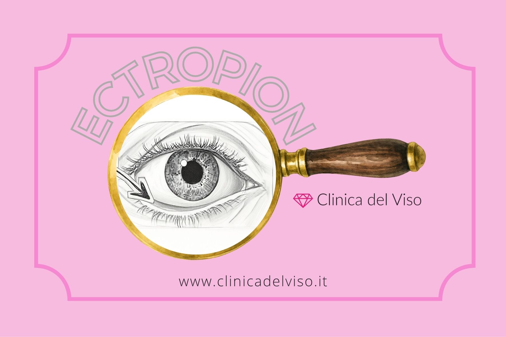 ectropion