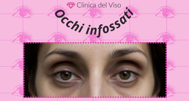 Home 10 occhi infossati
